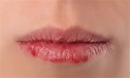 图片说明